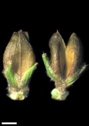 Veronica gibbsii. Capsules. Scale = 1 mm.
 Image: W.M. Malcolm © Te Papa CC-BY-NC 3.0 NZ